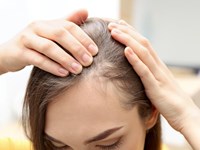 ¿Cómo puedo prevenir la caída del cabello?