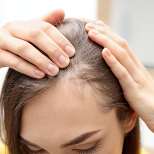 ¿Cómo puedo prevenir la caída del cabello?