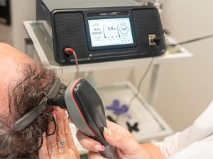 ¿Cuánto tiempo dura un tratamiento anticaída?