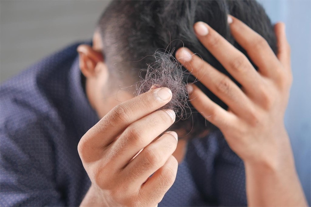 Diagnóstico y tratamiento de alopecia fibrosante frontal