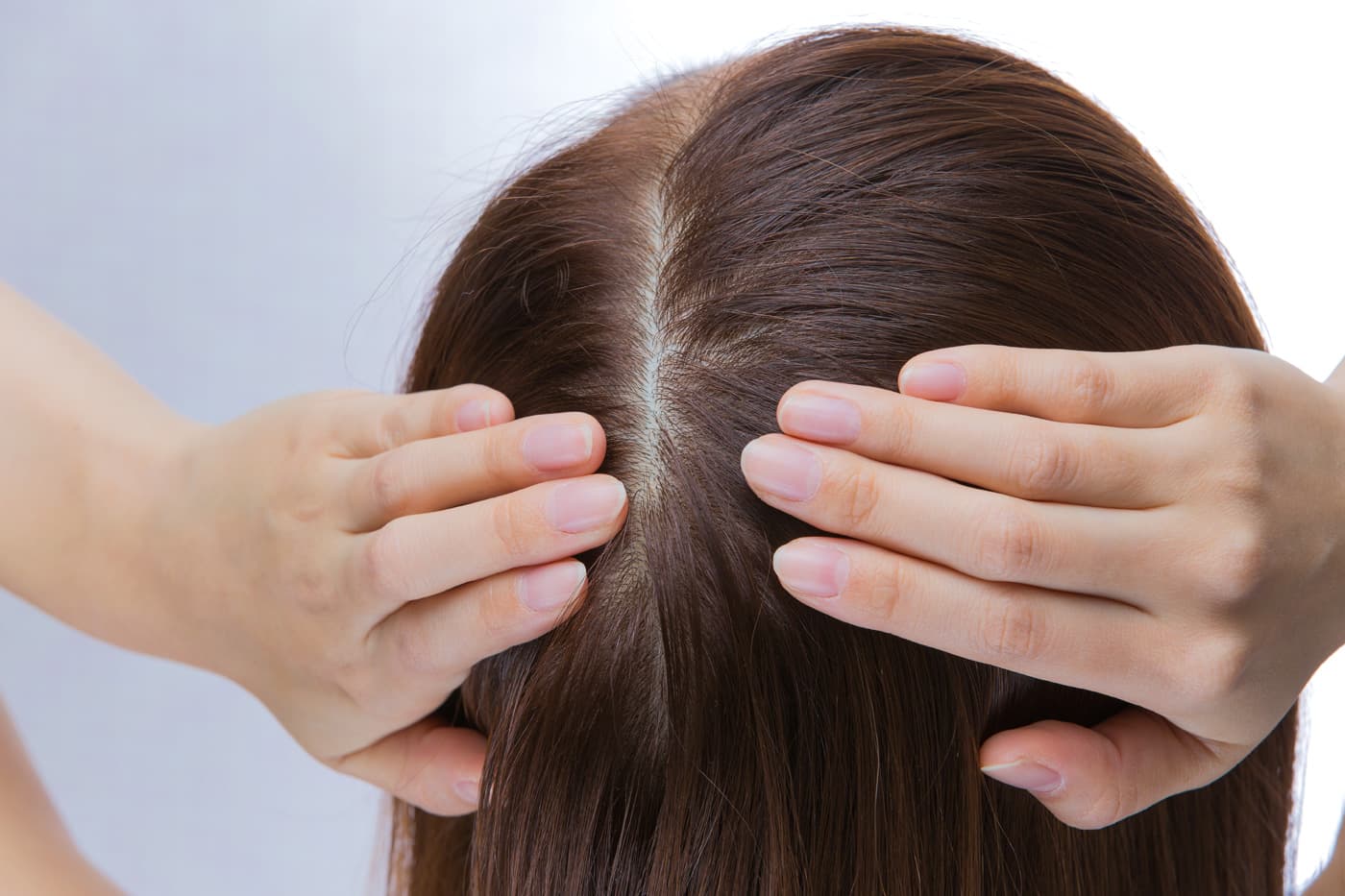 Tratamiento capilar para el picor del cuero cabelludo