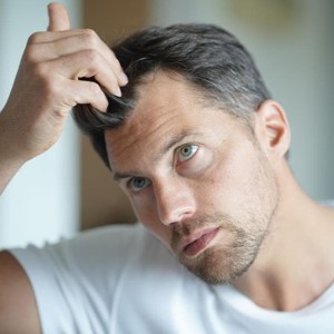 Las mejores prótesis capilares para hombres