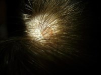  Los picores en el cuero cabelludo: causas y tratamientos seguir 