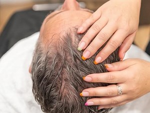 Mitos y verdades sobre la alopecia que debes conocer antes de tratarla