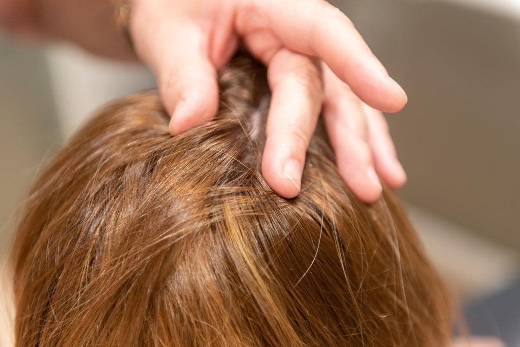 ¿Una peluca oncológica puede parecerse a mi pelo natural?