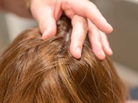 ¿Una peluca oncológica puede parecerse a mi pelo natural?